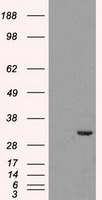 CDK5 Antibody - HEK293T cells were transfected with the pCMV6-ENTRY control (Left lane) or pCMV6-ENTRY CDK5 (Right lane) cDNA for 48 hrs and lysed. Equivalent amounts of cell lysates (5 ug per lane) were separated by SDS-PAGE and immunoblotted with anti-CDK5.