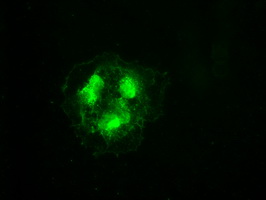 CDK5 Antibody - Anti-CDK5 mouse monoclonal antibody  immunofluorescent staining of COS7 cells transiently transfected by pCMV6-ENTRY CDK5.
