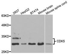 CDK5 Antibody - Western blot analysis of extracts of various cell lines, using CDK5 antibody.