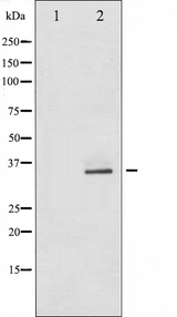 CDK5 Antibody - Western blot analysis of CDK5 expression in HepG2 whole cells lysates. The lane on the left is treated with the antigen-specific peptide.