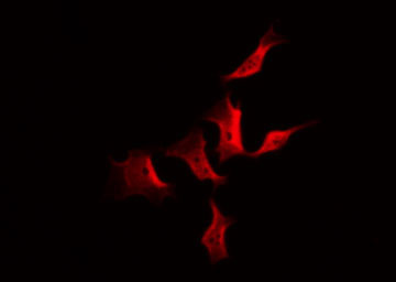 CDK5 Antibody - Staining COS7 cells by IF/ICC. The samples were fixed with PFA and permeabilized in 0.1% Triton X-100, then blocked in 10% serum for 45 min at 25°C. The primary antibody was diluted at 1:200 and incubated with the sample for 1 hour at 37°C. An Alexa Fluor 594 conjugated goat anti-rabbit IgG (H+L) Ab, diluted at 1/600, was used as the secondary antibody.