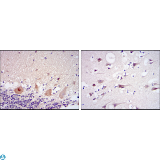 CDK5 Antibody - Immunohistochemistry (IHC) analysis of paraffin-embedded cerebellum tissues (left) and brain tissues (right) with DAB staining using Cdk5 Monoclonal Antibody.