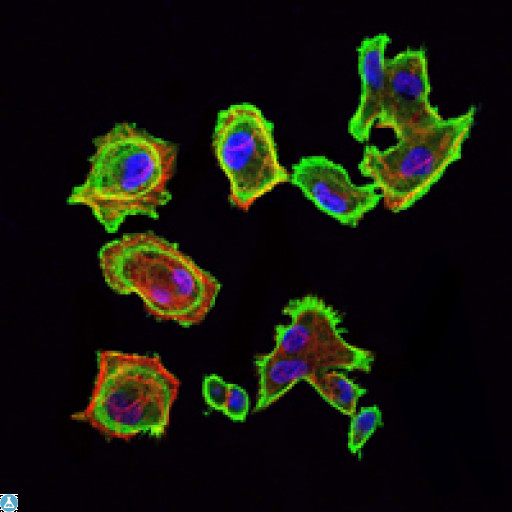 CDK5 Antibody - Immunofluorescence (IF) analysis of GC7901 cells using Cdk5 Monoclonal Antibody (green). Blue: DRAQ5 fluorescent DNA dye. Red: Actin filaments have been labeled with Alexa Fluor-555 phalloidin.