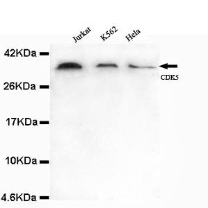 CDK5 Antibody - CDK5-N antibody at 1/1000 dilution Lane 1.