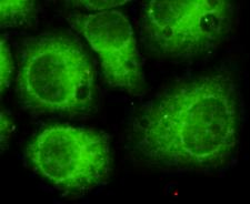 CDK5 Antibody - Immunocytochemistry of HeLa cells using anti- CDK5(N-terminus) antibody diluted 1:150.