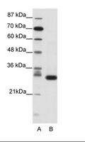 CDK5 Antibody - A: Marker, B: Jurkat Cell Lysate.  This image was taken for the unconjugated form of this product. Other forms have not been tested.