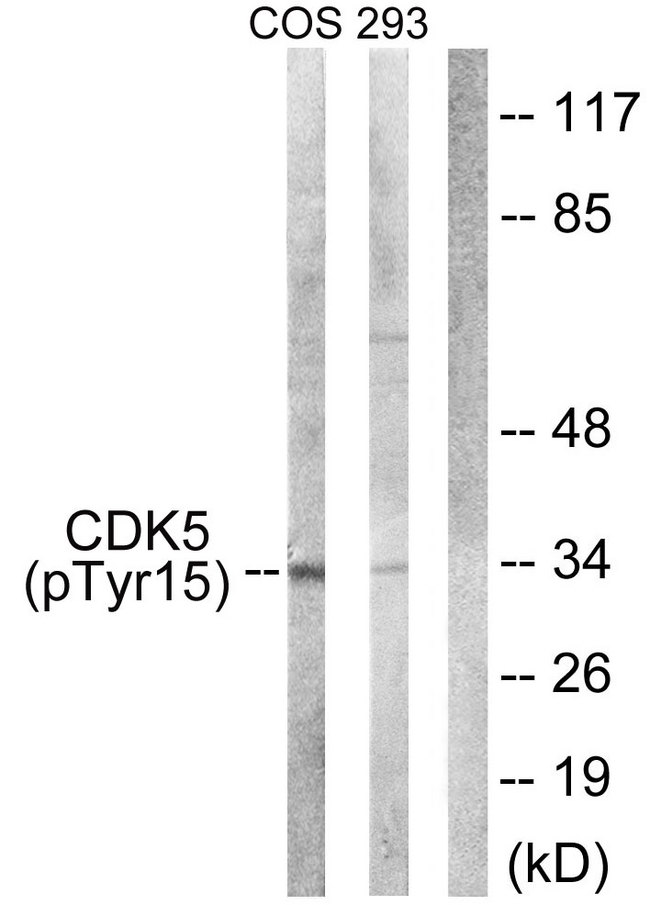 CDK5 Antibody - Western blot analysis of lysates from COS7 cells treated with EGF 200ng/ml 30' and 293 cells treated with H2O2 100u, 15mins, using CDK5 (Phospho-Tyr15) Antibody. The lane on the right is blocked with the phospho peptide.