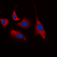 CDK5 Antibody - Immunofluorescent analysis of CDK5 (pY15) staining in HEK293T cells. Formalin-fixed cells were permeabilized with 0.1% Triton X-100 in TBS for 5-10 minutes and blocked with 3% BSA-PBS for 30 minutes at room temperature. Cells were probed with the primary antibody in 3% BSA-PBS and incubated overnight at 4 C in a humidified chamber. Cells were washed with PBST and incubated with a DyLight 594-conjugated secondary antibody (red) in PBS at room temperature in the dark. DAPI was used to stain the cell nuclei (blue).