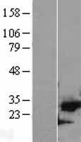 CDK5 Protein - Western validation with an anti-DDK antibody * L: Control HEK293 lysate R: Over-expression lysate