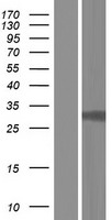 CDK5 Protein - Western validation with an anti-DDK antibody * L: Control HEK293 lysate R: Over-expression lysate