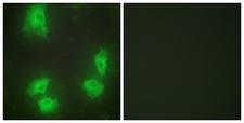 CDK5R1 Antibody - Immunofluorescence analysis of HeLa cells, using CDK5R1 Antibody. The picture on the right is blocked with the synthesized peptide.