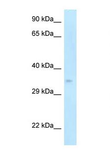 CDK5R1 Antibody - CDK5R1 / p35 antibody Western blot of Mouse Pancreas lysate. Antibody concentration 1 ug/ml.  This image was taken for the unconjugated form of this product. Other forms have not been tested.