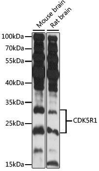 CDK5R1 Antibody - Western blot analysis of extracts of various cell lines, using CDK5R1 antibody at 1:3000 dilution. The secondary antibody used was an HRP Goat Anti-Rabbit IgG (H+L) at 1:10000 dilution. Lysates were loaded 25ug per lane and 3% nonfat dry milk in TBST was used for blocking. An ECL Kit was used for detection and the exposure time was 30s.