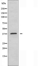 CDK5R1 Antibody - Western blot analysis of extracts of rat brain cells using CDK5R1 antibody.