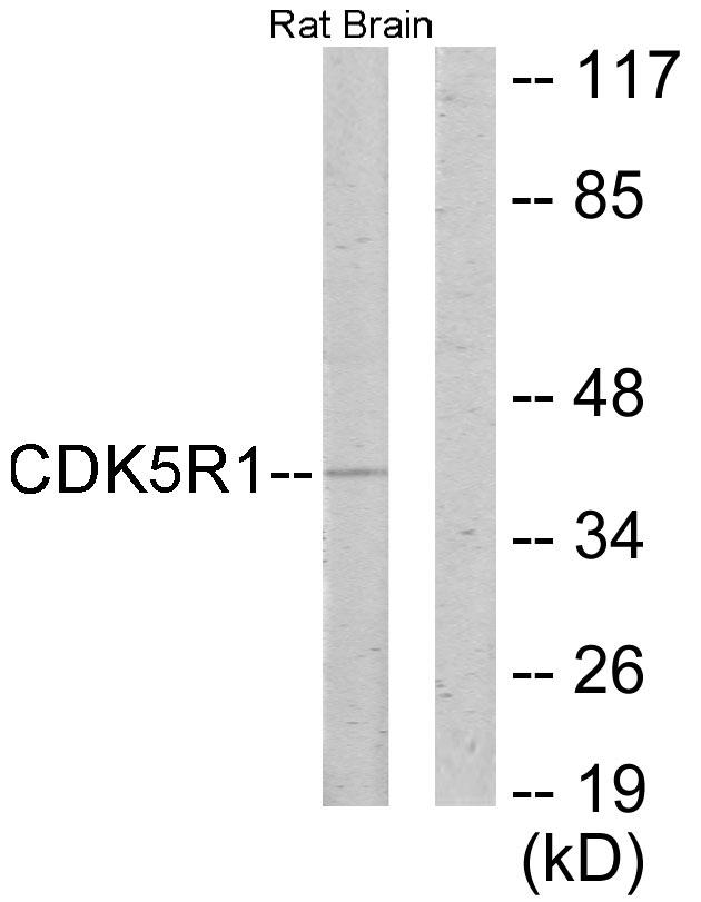 CDK5R1 Antibody - Western blot analysis of extracts from rat brain cells, using CDK5R1 antibody.