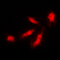CDK5R1 Antibody - Immunofluorescent analysis of p35 staining in HeLa cells. Formalin-fixed cells were permeabilized with 0.1% Triton X-100 in TBS for 5-10 minutes and blocked with 3% BSA-PBS for 30 minutes at room temperature. Cells were probed with the primary antibody in 3% BSA-PBS and incubated overnight at 4 C in a humidified chamber. Cells were washed with PBST and incubated with a DyLight 594-conjugated secondary antibody (red) in PBS at room temperature in the dark. DAPI was used to stain the cell nuclei (blue).