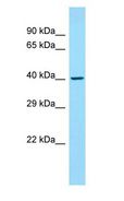 CDK5R2 Antibody - CDK5R2 / P39 antibody Western Blot of NCI-H226.  This image was taken for the unconjugated form of this product. Other forms have not been tested.