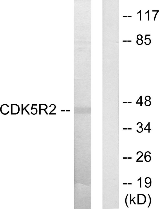 CDK5R2 Antibody - Western blot analysis of lysates from HUVEC cells, using CDK5R2 Antibody. The lane on the right is blocked with the synthesized peptide.