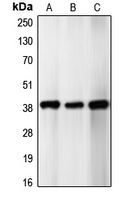 CDK5R2 Antibody - Western blot analysis of p39 expression in SHSY5Y (A); HeLa (B); U87MG (C) whole cell lysates.