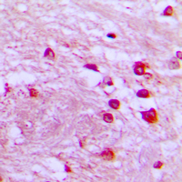 CDK5R2 Antibody - Immunohistochemical analysis of p39 staining in human brain formalin fixed paraffin embedded tissue section. The section was pre-treated using heat mediated antigen retrieval with sodium citrate buffer (pH 6.0). The section was then incubated with the antibody at room temperature and detected using an HRP conjugated compact polymer system. DAB was used as the chromogen. The section was then counterstained with hematoxylin and mounted with DPX.