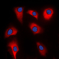 CDK5R2 Antibody - Immunofluorescent analysis of p39 staining in HeLa cells. Formalin-fixed cells were permeabilized with 0.1% Triton X-100 in TBS for 5-10 minutes and blocked with 3% BSA-PBS for 30 minutes at room temperature. Cells were probed with the primary antibody in 3% BSA-PBS and incubated overnight at 4 C in a humidified chamber. Cells were washed with PBST and incubated with a DyLight 594-conjugated secondary antibody (red) in PBS at room temperature in the dark. DAPI was used to stain the cell nuclei (blue).