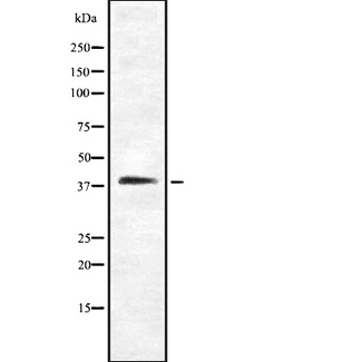 CDK5R2 Antibody - Western blot analysis of CDK5R2 using Jurkat whole cells lysates