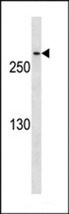 CDK5RAP2 Antibody - CDK5RAP2 Antibody western blot of HeLa cell line lysates (35 ug/lane). The CDK5RAP2 antibody detected the CDK5RAP2 protein (arrow).