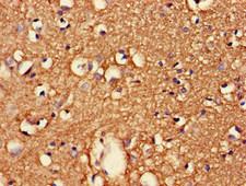 CDK5RAP2 Antibody - Immunohistochemistry of paraffin-embedded human brain tissue at dilution of 1:100