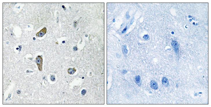 CDK5RAP2 Antibody - Peptide - + Immunohistochemistry analysis of paraffin-embedded human brain tissue using CDK5RAP2 antibody.
