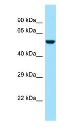 CDK5RAP3 Antibody - CDK5RAP3 antibody Western Blot of THP-1.  This image was taken for the unconjugated form of this product. Other forms have not been tested.
