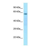 CDK5RAP3 Antibody - Western blot of Human Jurkat. CDK5RAP3 antibody dilution 1.0 ug/ml.  This image was taken for the unconjugated form of this product. Other forms have not been tested.