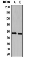 CDK5RAP3 Antibody - Western blot analysis of CDK5RAP3 expression in HeLa (A); A431 (B) whole cell lysates.