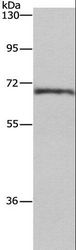 CDK5RAP3 Antibody - Western blot analysis of Human normal liver tissue, using CDK5RAP3 Polyclonal Antibody at dilution of 1:655.