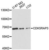 CDK5RAP3 Antibody - Western blot analysis of extracts of various cell lines, using CDK5RAP3 antibody at 1:3000 dilution. The secondary antibody used was an HRP Goat Anti-Rabbit IgG (H+L) at 1:10000 dilution. Lysates were loaded 25ug per lane and 3% nonfat dry milk in TBST was used for blocking. An ECL Kit was used for detection and the exposure time was 90s.