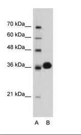CDK6 Antibody - Jurkat Cell Lysate.  This image was taken for the unconjugated form of this product. Other forms have not been tested.