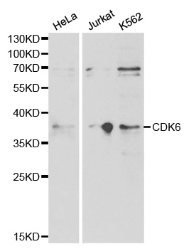 CDK6 Antibody - Western blot analysis of extracts of various cell lines, using CDK6 antibody at 1:1000 dilution. The secondary antibody used was an HRP Goat Anti-Rabbit IgG (H+L) at 1:10000 dilution. Lysates were loaded 25ug per lane and 3% nonfat dry milk in TBST was used for blocking.