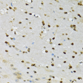 CDK6 Antibody - Immunohistochemistry of paraffin-embedded mouse brain using CDK6 antibodyat dilution of 1:100 (40x lens).