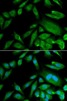CDK6 Antibody - Immunofluorescence analysis of MCF-7 cells using CDK6 antibody. Blue: DAPI for nuclear staining.