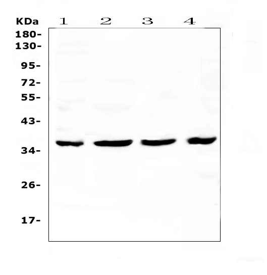 CDK6 Antibody - Western blot analysis of Cdk6 using anti-Cdk6 antibody. Electrophoresis was performed on a 5-20% SDS-PAGE gel at 70V (Stacking gel) / 90V (Resolving gel) for 2-3 hours. The sample well of each lane was loaded with 50ug of sample under reducing conditions. Lane 1: human Hela whole cell lysates,Lane 2: human SGC-7901 whole cell lysates,Lane 3: human K562 whole cell lysates,Lane 4: mouse SP20 whole cell lysates. After Electrophoresis, proteins were transferred to a Nitrocellulose membrane at 150mA for 50-90 minutes. Blocked the membrane with 5% Non-fat Milk/ TBS for 1.5 hour at RT. The membrane was incubated with rabbit anti-Cdk6 antigen affinity purified polyclonal antibody at 0.5 ?g/mL overnight at 4?C, then washed with TBS-0.1% Tween 3 times with 5 minutes each and probed with a goat anti-rabbit IgG-HRP secondary antibody at a dilution of 1:10000 for 1.5 hour at RT. The signal is developed using an Enhanced Chemiluminescent detection (ECL) kit with Tanon 5200 system. A specific band was detected for Cdk6 at approximately 37KD. The expected band size for Cdk6 is at 37KD.