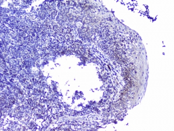 CDK6 Antibody - IHC staining of FFPE human tonsil tissue with Cdk6 antibody at 1ug/ml. HIER: boil tissue sections in pH6, 10mM citrate buffer, for 10-20 min followed by cooling at RT for 20 min.