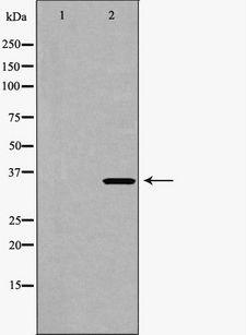 CDK6 Antibody - Western blot analysis of HeLa whole cells lysates using CDK6 antibody. The lane on the left is treated with the antigen-specific peptide.