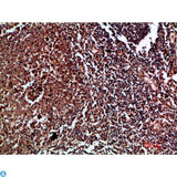 CDK6 Antibody - Immunohistochemical analysis of paraffin-embedded human-tonsil, antibody was diluted at 1:200.
