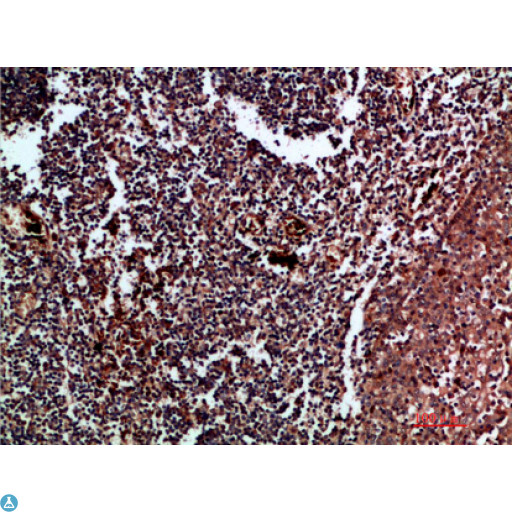 CDK6 Antibody - Immunohistochemical analysis of paraffin-embedded human-tonsil, antibody was diluted at 1:200.