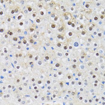 CDK6 Antibody - Immunohistochemistry of paraffin-embedded Mouse liver using CDK6 Polyclonal Antibody at dilution of 1:100 (40x lens).