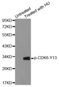 CDK6 Antibody - Western blot analysis of extracts from 293 cells.