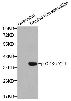CDK6 Antibody - Western blot analysis of extracts from 293 cells.