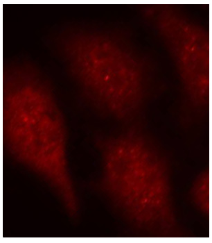 CDK6 Antibody - Immunofluorescence staining of methanol-fixed Hela cells.