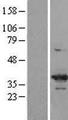 CDK6 Protein - Western validation with an anti-DDK antibody * L: Control HEK293 lysate R: Over-expression lysate