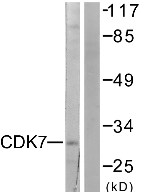 CDK7 Antibody - Western blot analysis of lysates from 293 cells, using CDK7 Antibody. The lane on the right is blocked with the synthesized peptide.