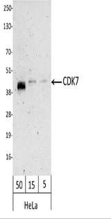 CDK7 Antibody - Detection of Human CDK7 by Western Blot. Samples: Whole cell lysate from HeLa (50, 15, and 5 ug). Antibody: Affinity purified, biotin-conjugated, rabbit anti-CDK7 antibody used at 1.0 ug/ml. Detection: Streptavidin-HRP and chemiluminescence with an exposure time of 3 minutes. This image was taken for the unconjugated form of this product. Other forms have not been tested.